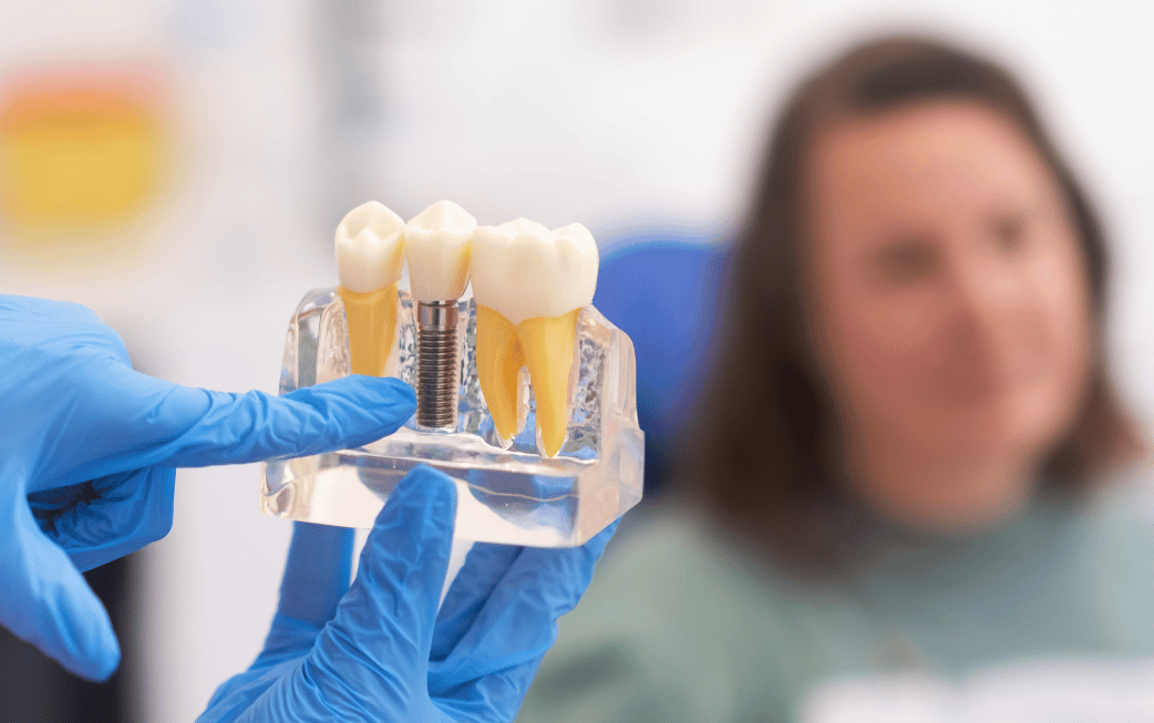 Immediate dental implant placement Edmond OK